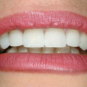 Cosmetic Dentistry Meriden CT